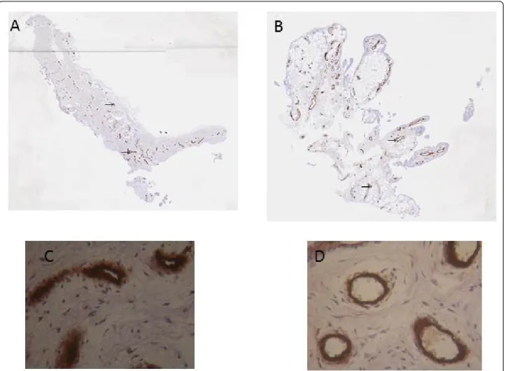 Figure 3 Immunohistochemical detection of blood vessels in NR (A and C) and in I (B and D) synovial biopsies
