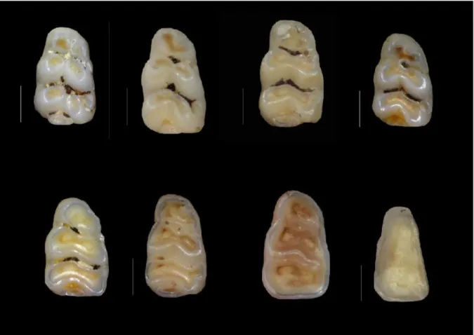 Figure 9 : Schémas d'usure de la première molaire inférieure. L'usure se fait de la gauche vers la droite et du haut vers le  bas