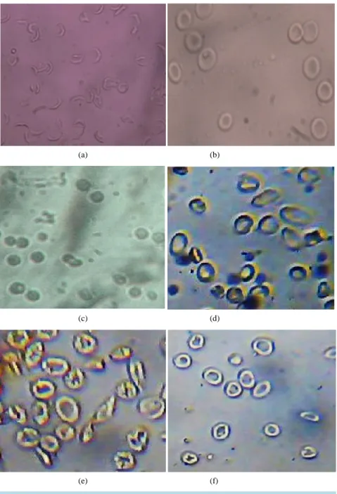 Figure  3.  Morphology  of  erythrocytes  of  untreated  SS  blood  (negative  control,  a); 