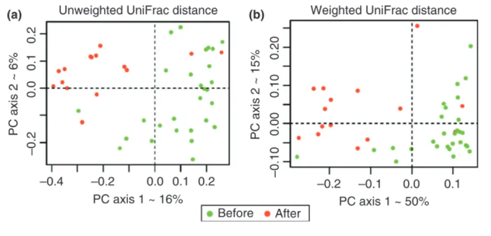 Figure 1 | Beta-diversity comparisons of the gut microbiomes of the faecal samples collected before chemotherapy and after chemotherapy