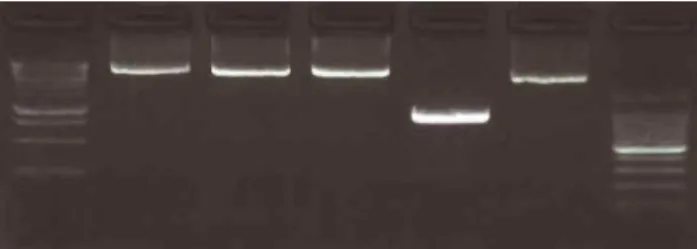 Figure  4 :  Révélation  au  transilluminateur  UV  de  la  migration  par  électrophorèse  des  produits  PCR  pour  cinq  brèches du  génome Nizo2877