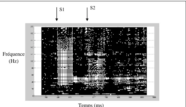 Figure 11 : Exemple de résultat obtenu pour l'atténuation (S1: stimulation 1, S2: stimulation 2)