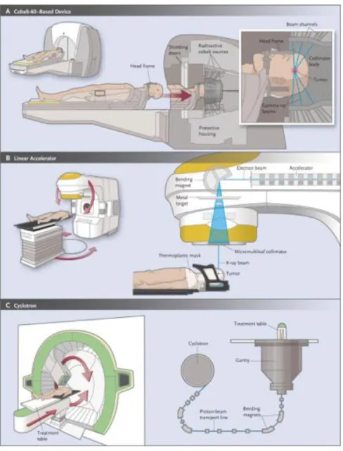 Figure 3 : radiochirurgie via différentes machines 47