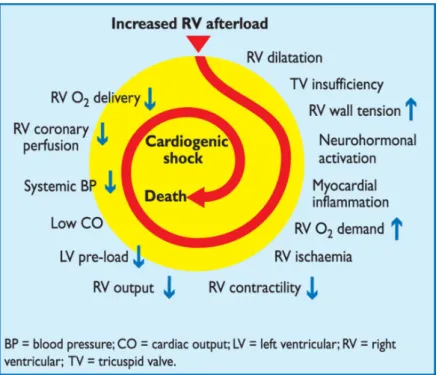 Figure 4 - Mécanismes entraînant le choc cardiogénique d'après la société européenne de cardiologie (1)