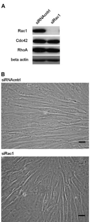 Fig. 1. siRac1 efficiently inhibit Rac1 expression without affecting the morphology of fibroblasts
