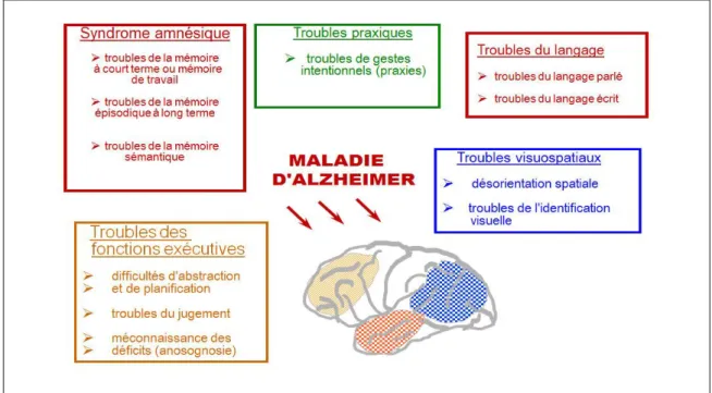 Figure 3:  troubles causés par la maladie d’Alzheimer, (Futura-Sciences, Du vieillissement cérébral à  la maladie d’Alzheimer, décryptage scientifique, Geneviève Leuba)