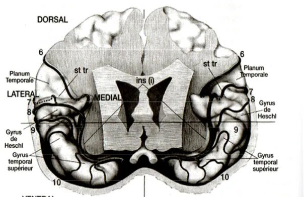 Figure 3 : Vue frontale montrant les gyri temporaux supérieurs. (adapté de Szikla et al., 1977)     LECHEVALIER B., PLATEL H., EUSTACHE F., Le cerveau musicien, neuropsychologie     et psychologie cognitive de la perception musicale p.50 