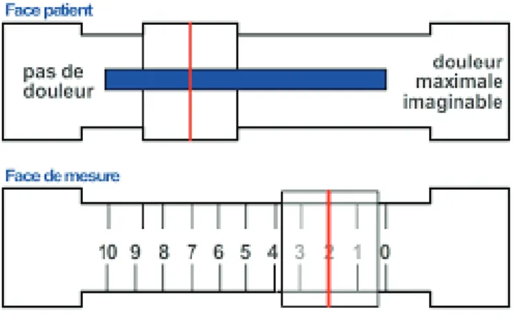 Fig. 5. EVA  Echelle visuelle analogique 