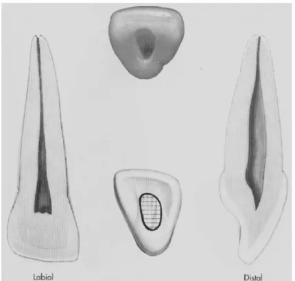 Figure 3 : planche anatomique de l’incisive latérale maxillaire   (Burnes et Herbranson 1998) 