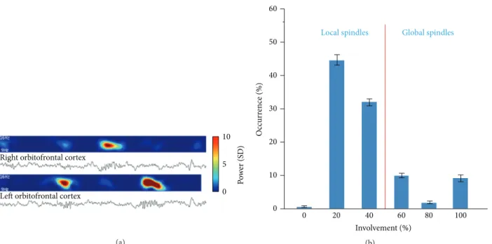 Figure 5: Local spindles. (a) An example of local spindles. Depth EEG along with corresponding spectrograms in the spindle frequency range (9–16 Hz) during 15 s of slow wave sleep
