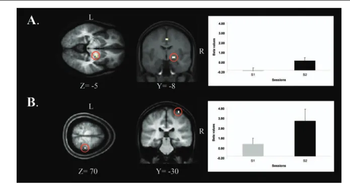TABLE III. MNI coordinates and signiﬁcance scores of the brain regions showing an increase in BOLD activity for the delayed retest – immediate post-training contrasts