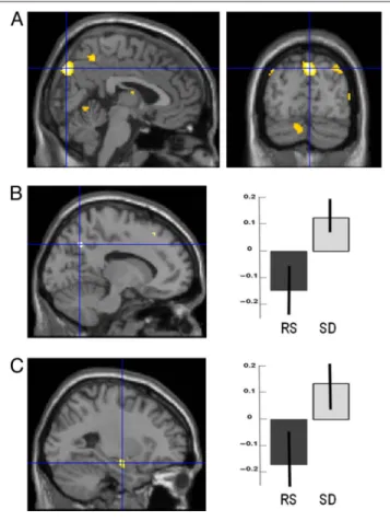 Figure 5. Sleep-dependent changes in functional integration. PPI analysis showing brain areas where activity is differentially coupled with activity in the source area of the right cuneus ([A]; 2, −82, 40 mm in the MNI space)