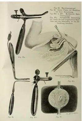 Figure 6 : Instruments de ventroscopie