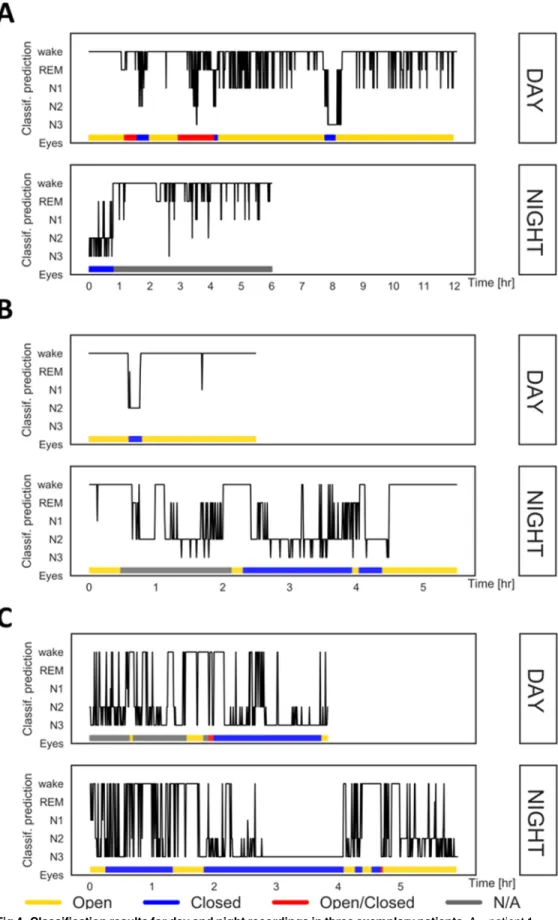 Fig 4. Classification results for day and night recordings in three exemplary patients