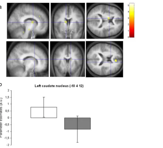 Figure 2. Within-subjects correlation analyses between brain activity and trial to trial performance in the Natural condition.
