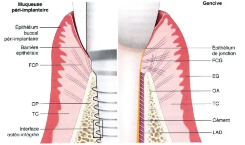 Figure 5 : Principales différences entre le modèle parodontal et le modèle péri-implantaire 