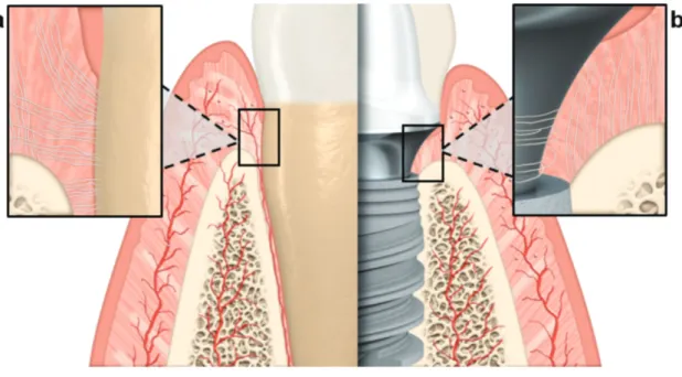 Figure 40 : Comparaison des caractéristiques des tissus mous parodontaux et péri-implantaires 