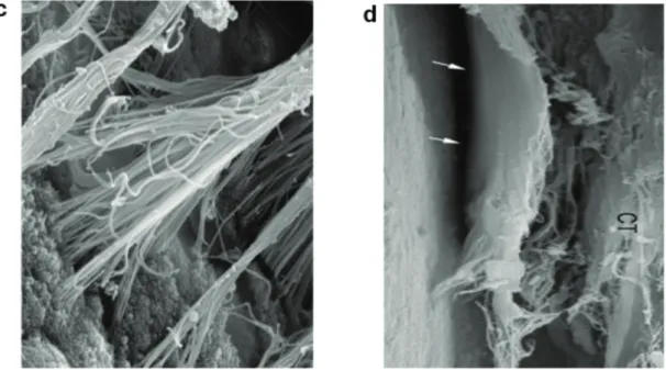 Figure 41 : Comparaison des caractéristiques des tissus mous parodontaux et péri-implantaires