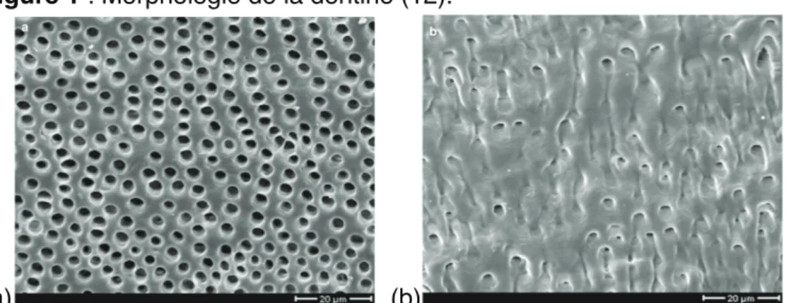 Figure 1 : Morphologie de la dentine (12). 