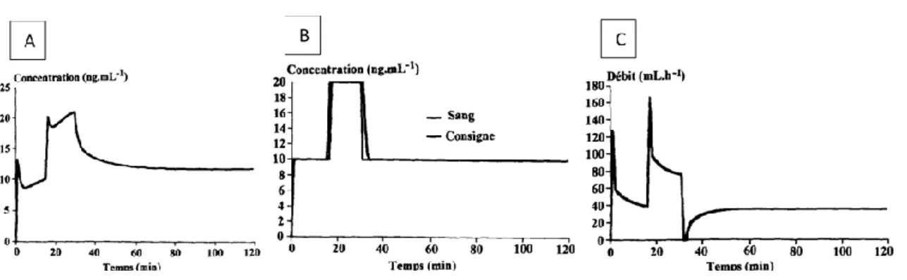 Figure 3 : Comparaison de deux modes d’administration dans le but d’obtenir une concentration  plasmatique de rémifentanil à 10, puis 20, et de nouveau 10ng/ml