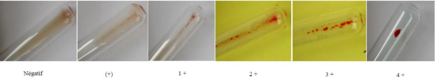 Figure 6. Gamme d’intensité d’agglutination en technique tube (D’après le CNRGS, INTS- INTS-Institut National de la Transfusion Sanguine Paris)