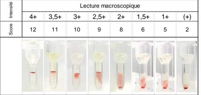 Figure 7. Gamme d’intensité d’agglutination en technique carte gel (D’après le CNRGS, INTS  Paris)