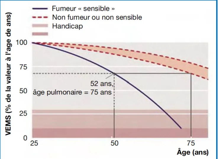 Figure 6 : Estimation de l’âge pulmonaire en fonction du VEMS. (18)  Parkes G, Greenhalgh T, Griffin M, Dent R