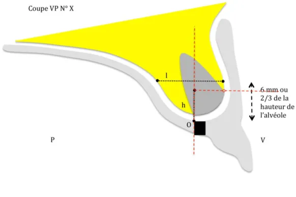 Figure 3 : Schéma des Mesures Radiologiques 