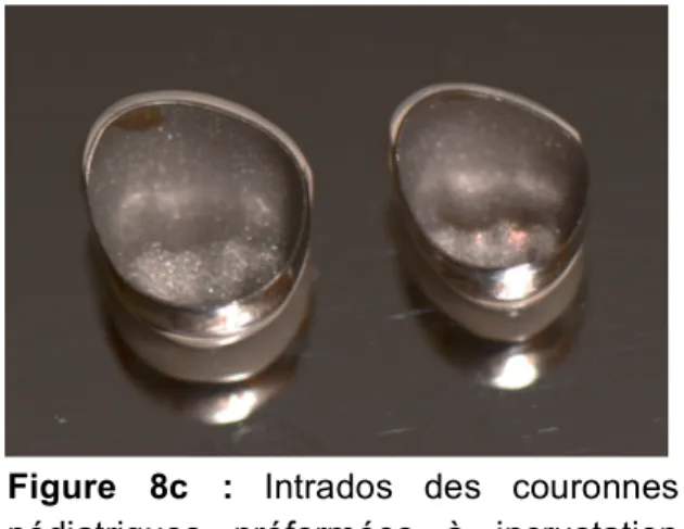 Figure  8c  :  Intrados  des  couronnes  pédiatriques  préformées  à  incrustation  NuSmile ®   Primary  Crown  postérieures  (Service  d’Odontologie  Pédiatrique  du  CHU  Saint-Roch, Nice)