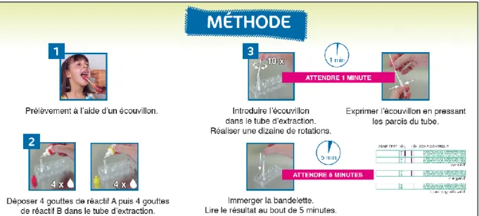 Figure 4 : Méthode de réalisation du test rapide oropharyngé des angines à Streptocoque A (73) 