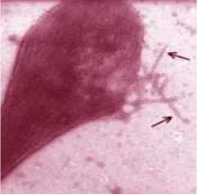 Figure 8: Observation au microscope d’un globule rouge en cours de polymérisation 