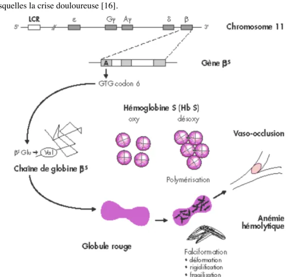 Figure 9: Schéma physiopathologique de la drépanocytose [22] 