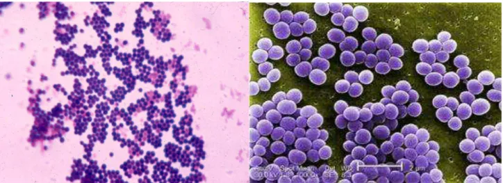 Figure 7 : Cocci Gram positif ; microscopie optique.