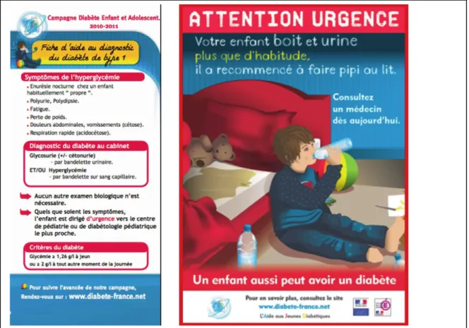 Figure 1 : Campagne d’information de l’AJD. Affiche pour l’information du grand  public (à droite) et fiche diagnostique destinée aux professionnels (à gauche)