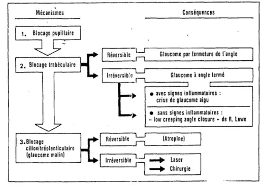 Figure 5 : Physiopathologie du glaucome par fermeture de l'angle 