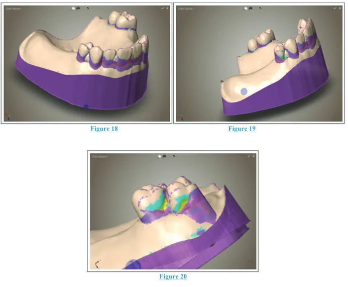 Figure 18                                                                 Figure 19 