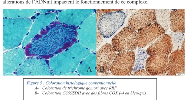 Figure 5 : Coloration histologique conventionnelle  A-  Coloration de trichrome gomori avec RRF 