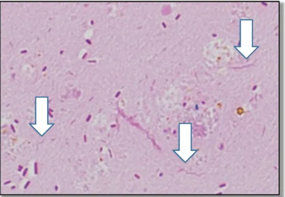 Figure 6 : Campylobacter jejuni (cf flèches) à la coloration de Gram (Kamata et Tokuda, 2014)  [48]