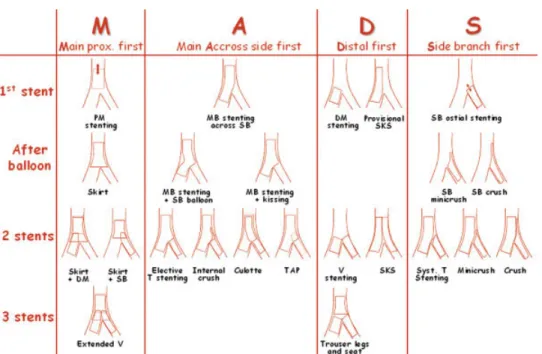 Fig. 3. MADS classiﬁcation of techniques (standard techni- techni-ques). In ‘‘M’’ family the ‘‘Skirt’’ technique was described with use of a stent manually crimped onto two balloons, but it is currently used with a dedicated stent (DEVAX)