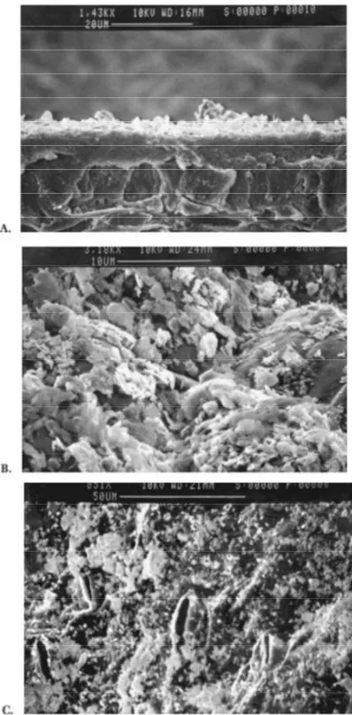 Figure 9: Couche de kaolin (Surround ® ) sur une feuille de pommier vu au  microscope électronique à balayage