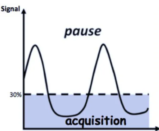 Figure 8: Synchronisation respiratoire par ceinture pneumatique: l'acquisition est effectuée en fin  d'expiration avec un seuil à 30%