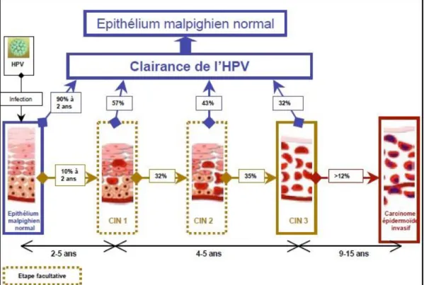 Figure 8 - Histoire naturelle du carcinome épidermoïde du col utérin (source : InVS - données épidémiologiques  sur le cancer du col de l'utérus - 2008) 