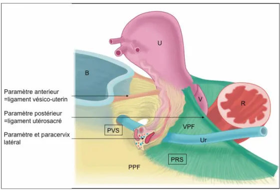 Figure 11 - Différentes portions du paramètre. B = vessie ; U = utérus ; V = vagin ; R = rectum ; Ur = uretère ;  PPF = fascia pelvien pariétal ; VPF = fascia pelvien viscéral (Touboul, Am J Obstet Gynecol 2008 (52)) 