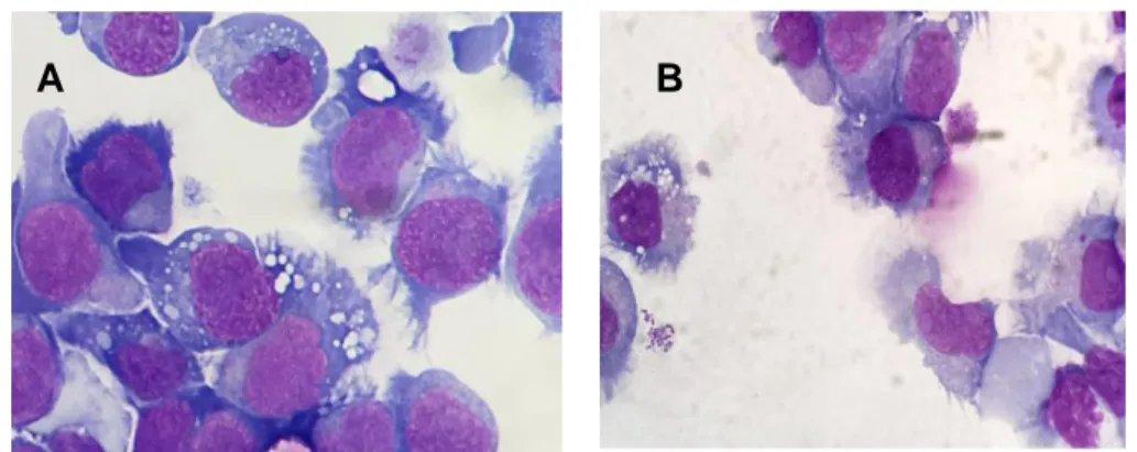 Figure 8 Aspect cytologique des lignées JVM-3 et BONNA-12  A : JVM-3 