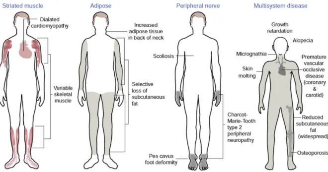 Figure 1 : Mutations de la lamine A/C responsables de phénotypes tissu-spécifiques Les mutations du gène de la lamine A/C sont responsables de pathologies variées allant de l’atteinte  d’un tissu spécifique (muscle strié, tissu adipeux, nerf périphérique) 