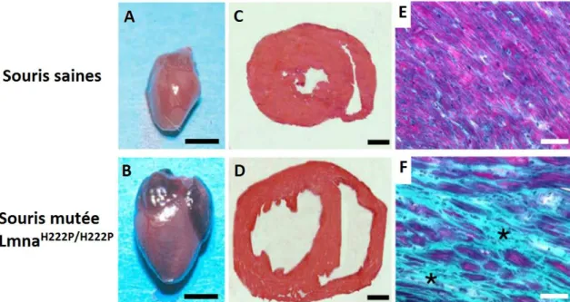 Figure 10 : Comparaison des phénotypes cardiaques de souris saines et porteuses d’une  laminopathie (Lmna H222P/H222P)