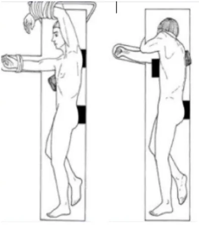 Figure 7 : incisions en cas de thoracoscopie droite (A) - de VATS droite (B) - de thoracotomie droite (C) Figure  5 :  installation  de  la  patiente  pour 