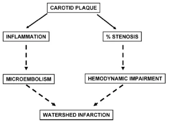 Figure 8 : hypothèse physiopathologique sur la genèse des infarctus jonctionnels (49) 