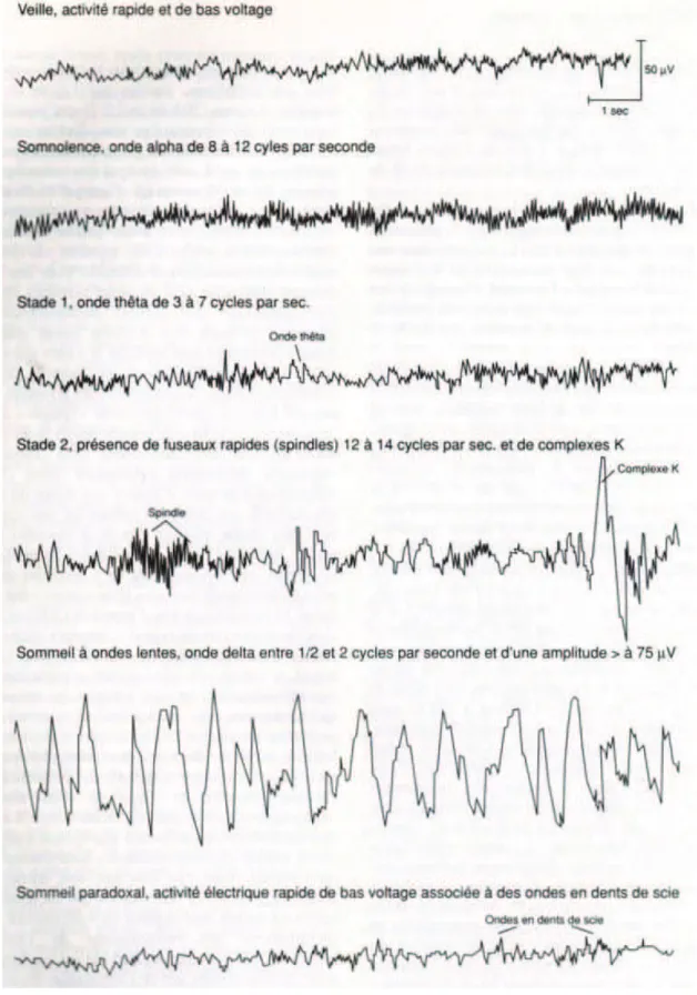 Fig. 2.1: Tracé EEG de la veille et des différents stades de sommeil