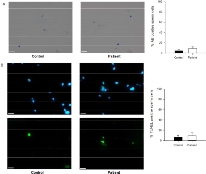 Figure  2  Measure  of  DNA  condensation  and  fragmentation. 